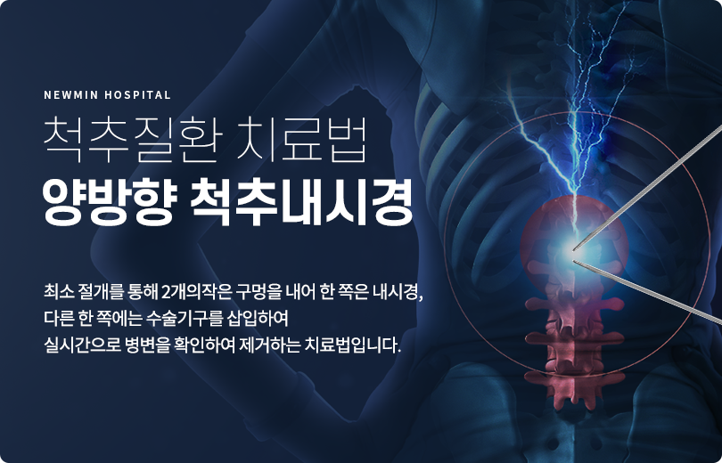 양방향척추내시경 썸네일