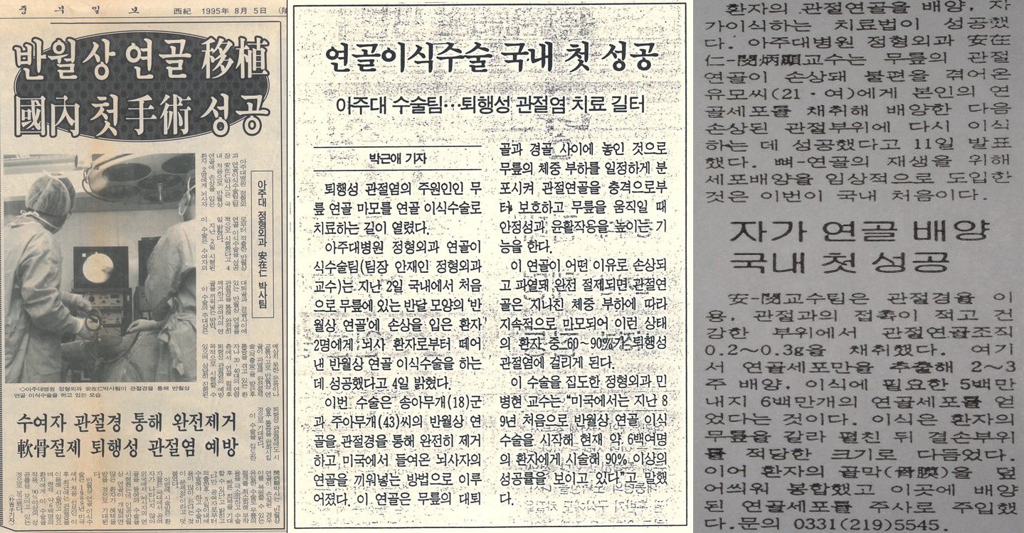 민병현 대표원장의 국내 첫 반월상 연골 이식·연골이식수술 성공을 다룬 신문 기사